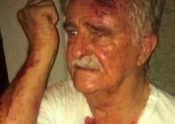 Senhor de 81 anos é agredido por universitário em festa de república