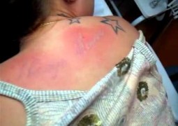 Canadense cria creme capaz de remover tatuagens sem dor
