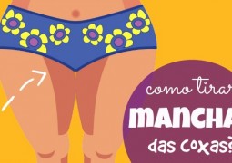 Manchas escuras entre as coxas: elimine definitivamente com dicas de dermatologista