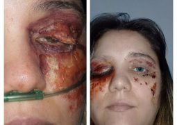 Após ser presa por enganar á todos com falsa infecção nos olhos em São Gotardo, mulher tem liberdade provisória concedida