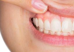 Dica: Saiba com escolher uma clínica para fazer implante dentário em São Gotardo